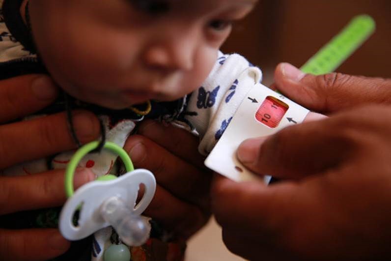 Eight-month old Nadira* is screened for malnutrition in Jawzjan, Afghanistan. Nadira has been diagnosed with severe acute malnutrition (SAM), as drought and poverty take their toll. Photo by Shekiba Mohammadi/Save the Children.