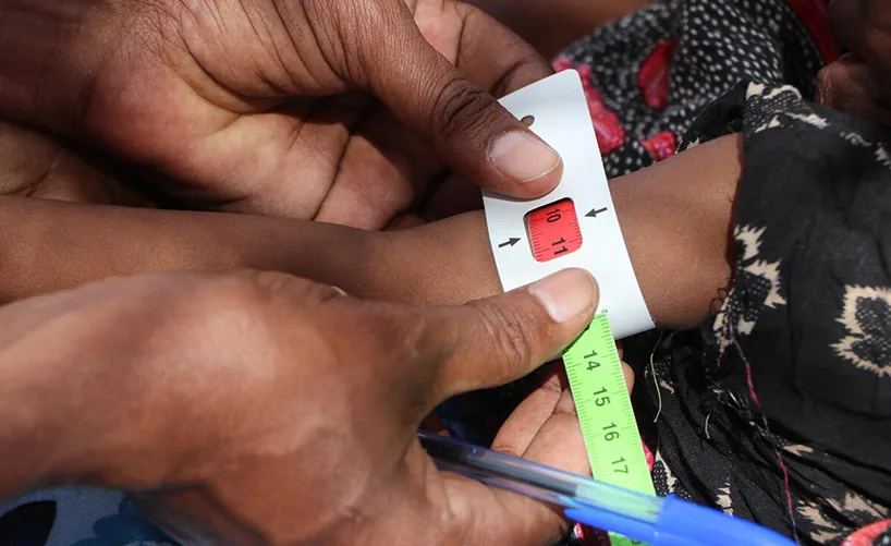 Baby Ruqiya (2) has her mid-upper arm checked for signs of malnutrition